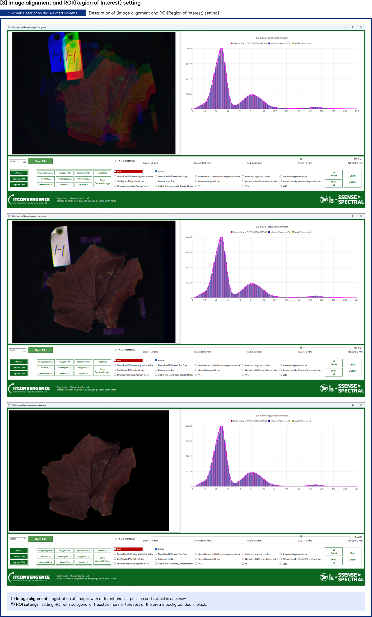 Description of Image alignment and ROI(Region of Interest) setting